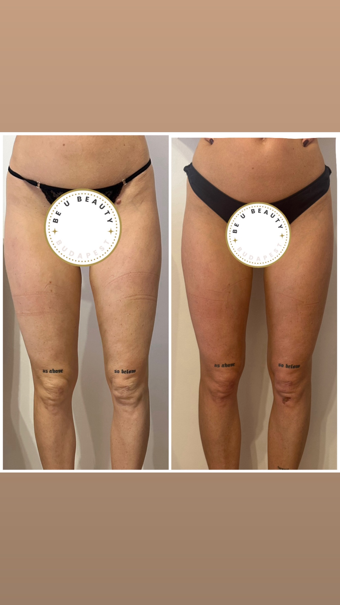 Alakformálás eredmény