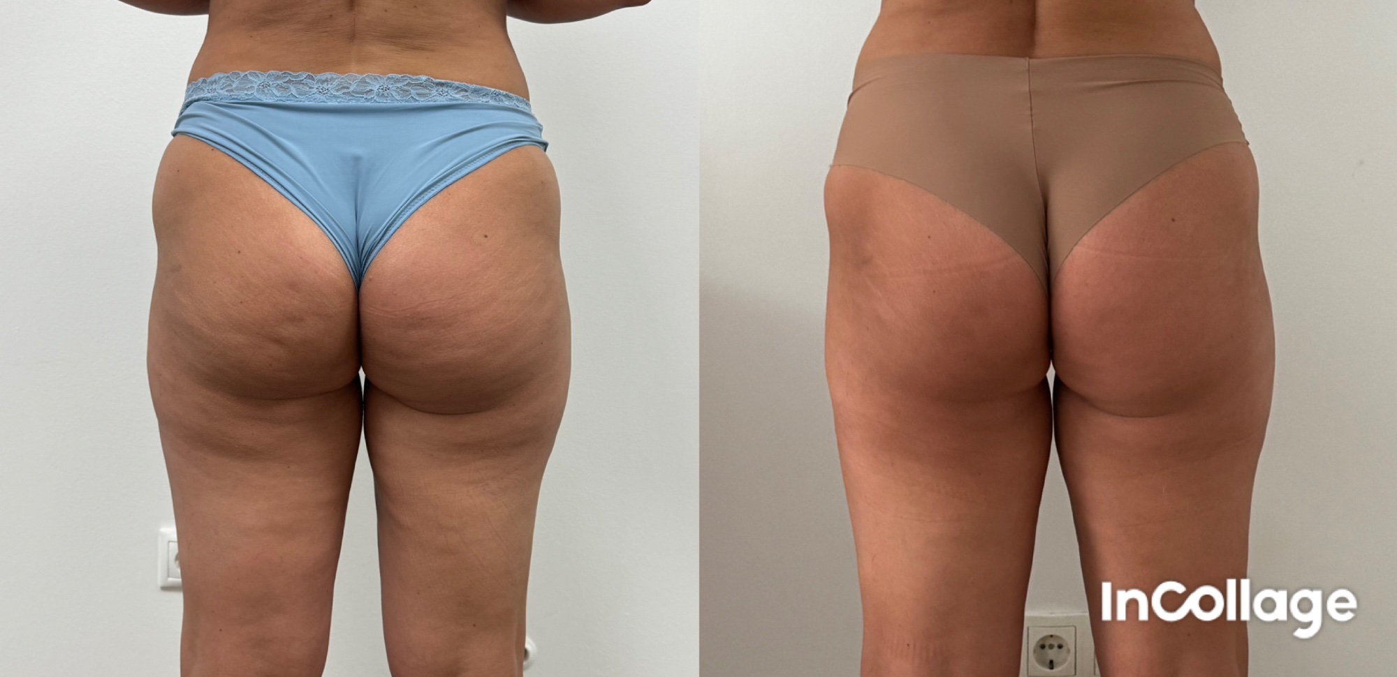 Alakformálás eredmény