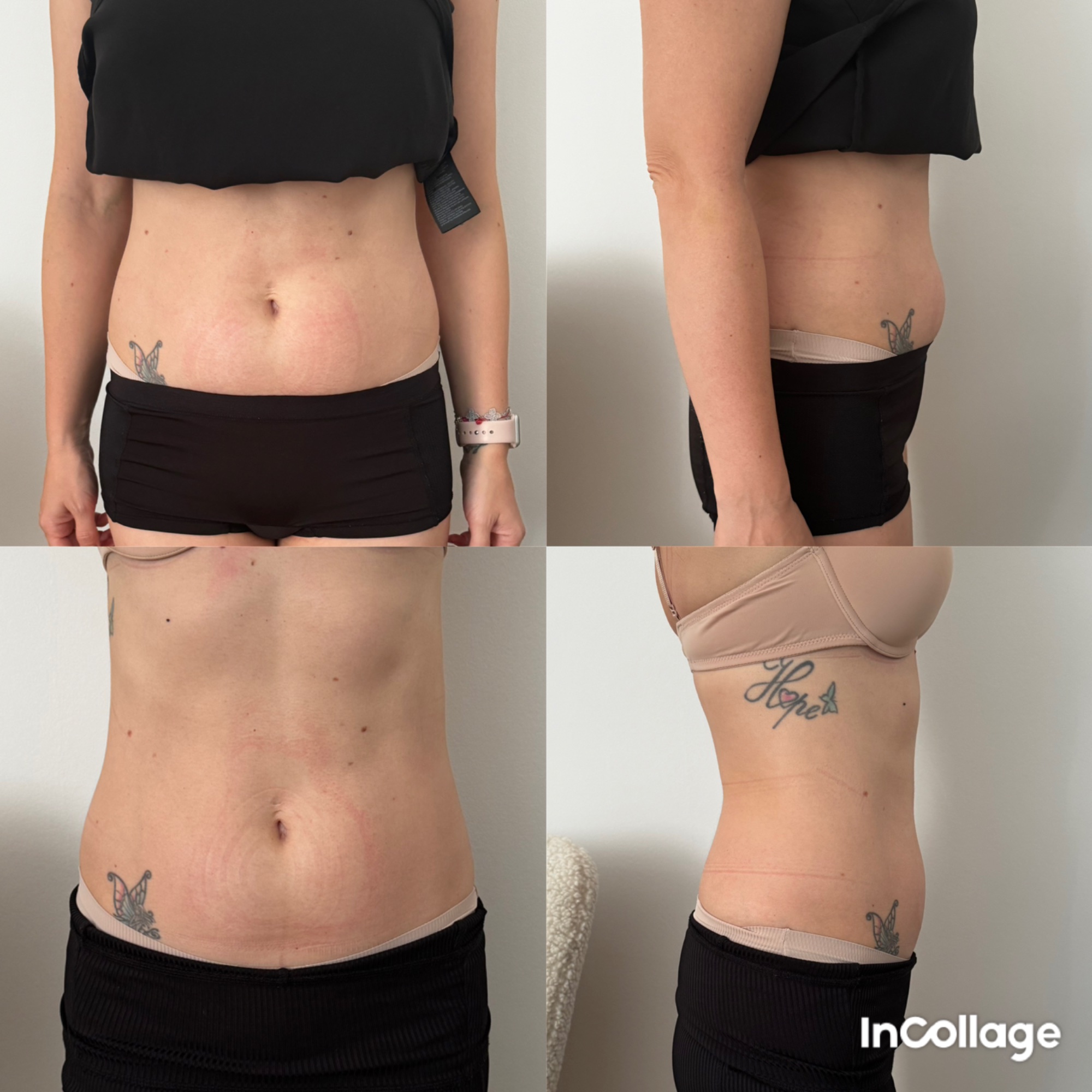 Be U Beauty alakformálás eredmény