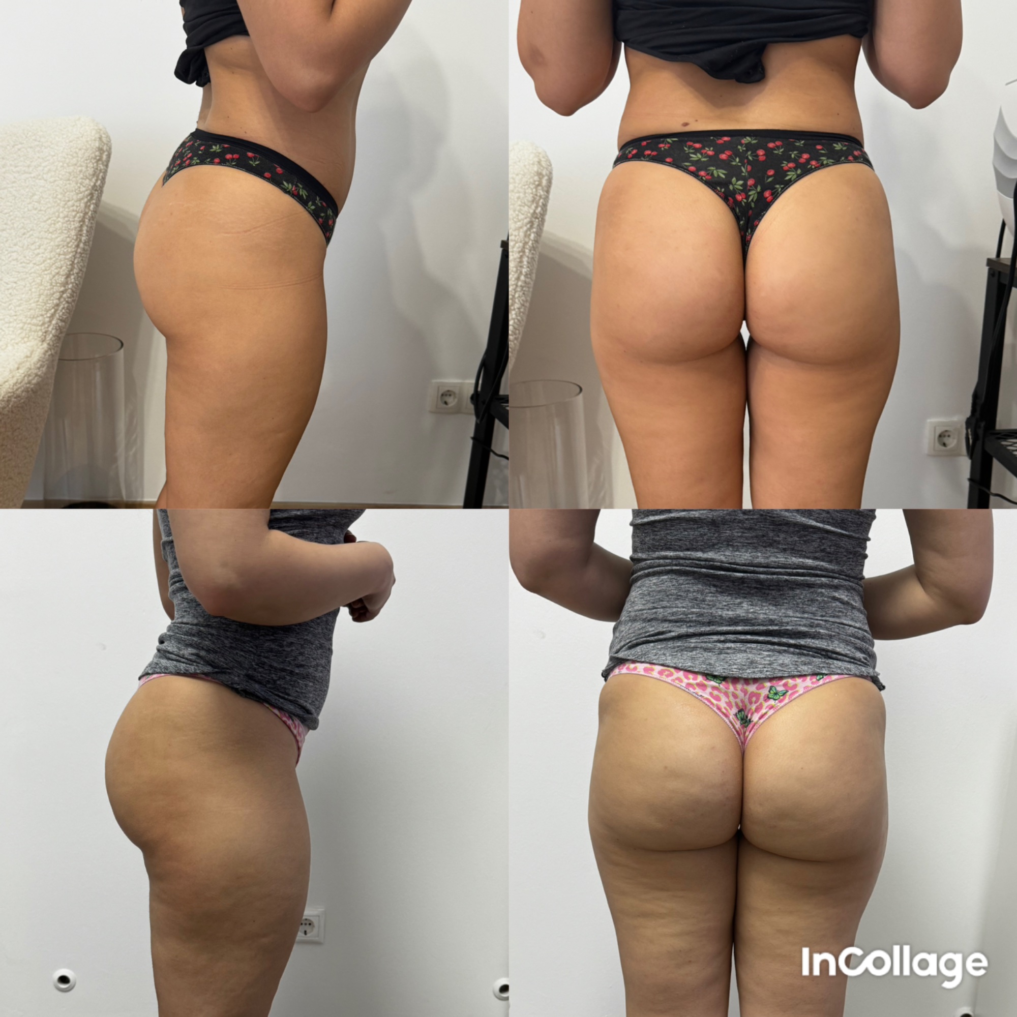 Alakformálás eredmény