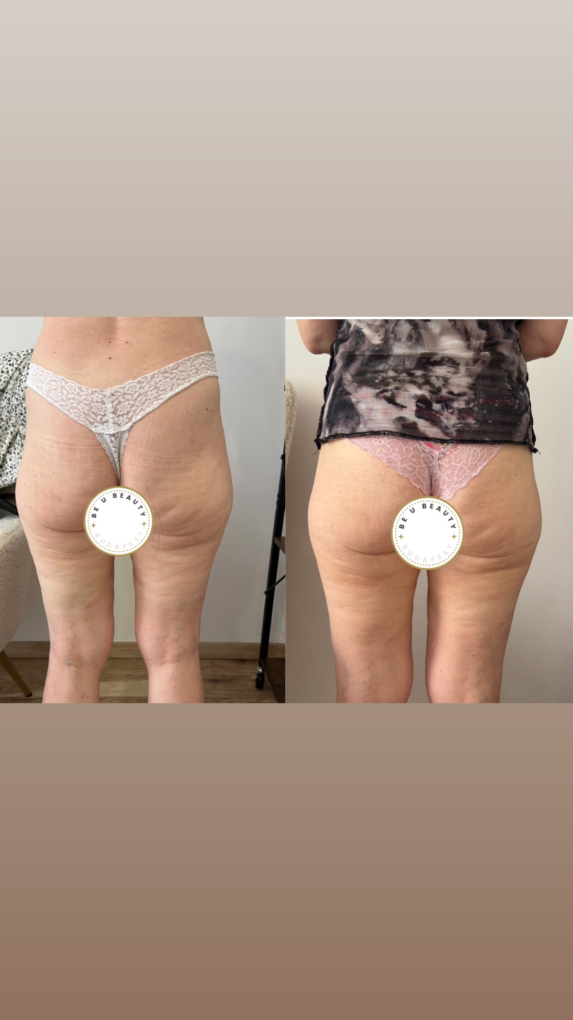 Alakformálás eredmény