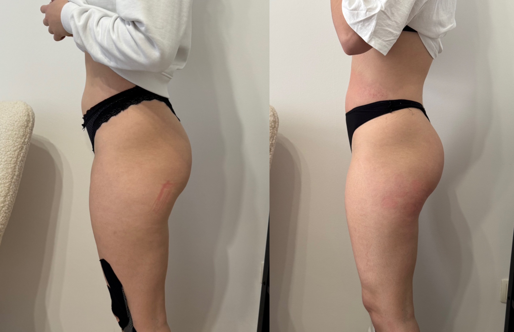 Alakformálás eredmény