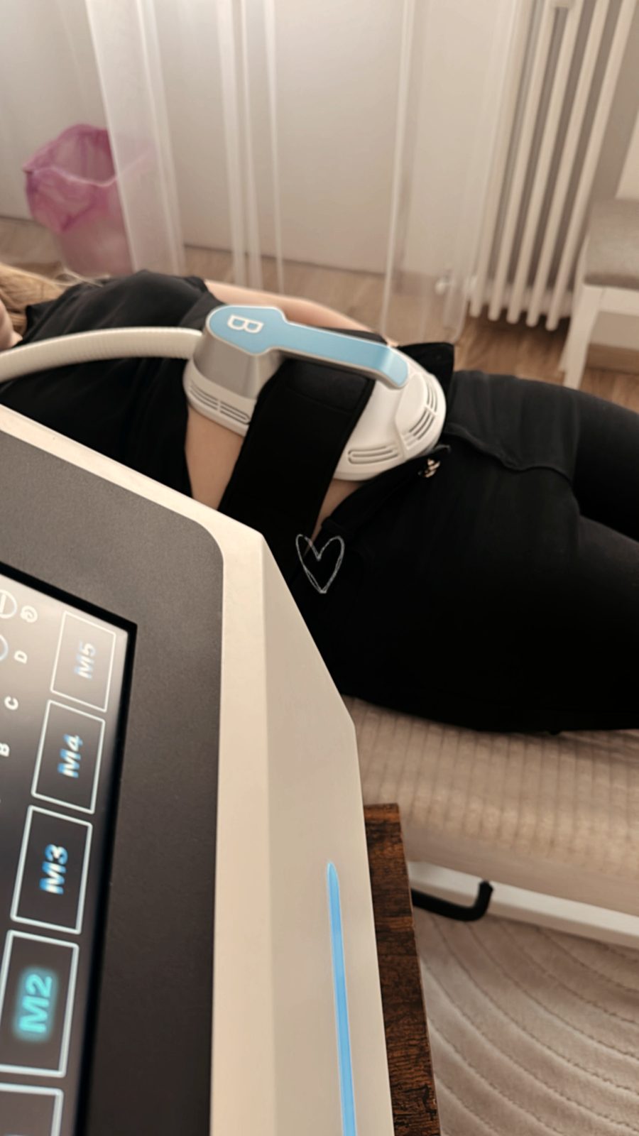 NarancsbőrSTOP cellulite protocol treatment in progress